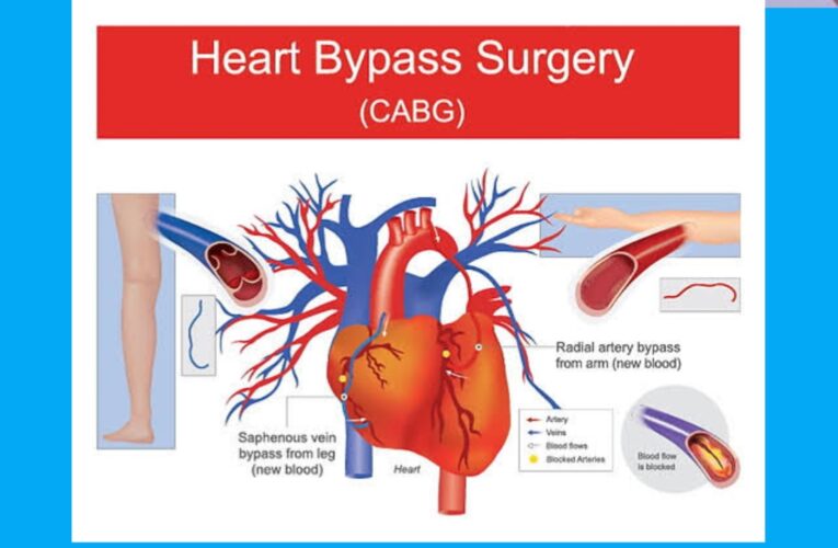 Bypass surgery in hindi